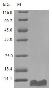 C-C motif chemokine 20 protein (CCL20) (Active), human, recombinant
