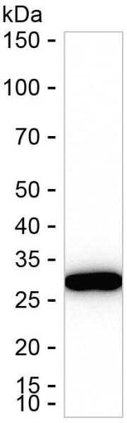 Anti-NQO1