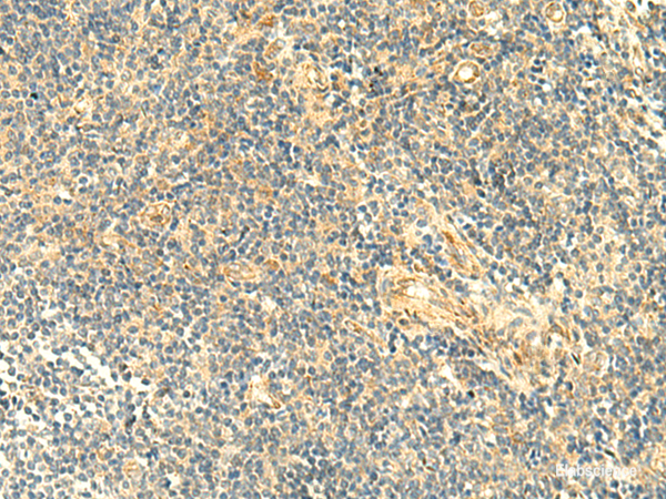 Anti-ASB6