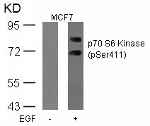Anti-phospho-p70 S6 Kinase (Ser411)