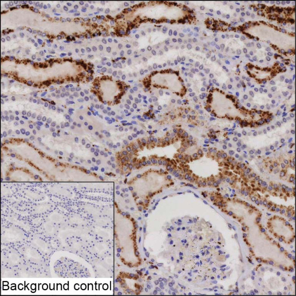 Anti-Cathepsin H