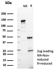 Anti-BTBD9 / BTB/POZ domain-containing protein 9, clone BTBD9/7501