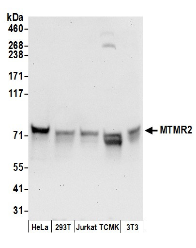 Anti-MTMR2