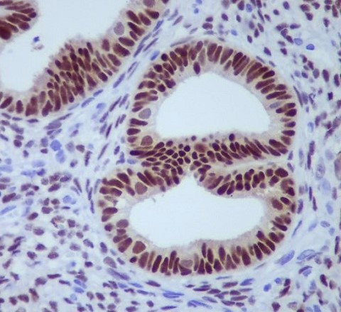 Anti-Progesterone receptor