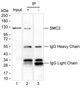 Anti-SMC2 (acetyl K114)