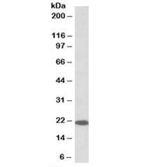 Anti-Dnajc5