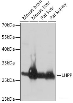 Anti-LHPP
