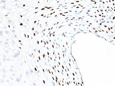 Anti-CMV-p65(CMV101), CF568 conjugate, 0.1mg/mL