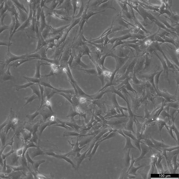 HBZY-1 Cells