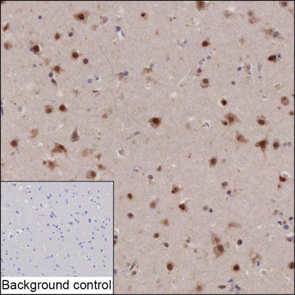Anti-ZNF346