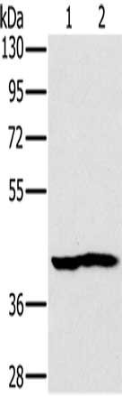 Anti-NDUFA10