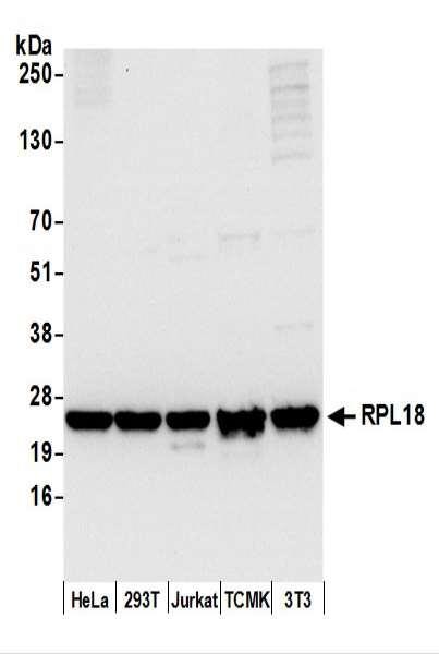 Anti-RPL18/Ribosomal Protein L18