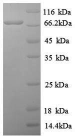 Proto-oncogene c-Rel (REL), partial, human, recombinant