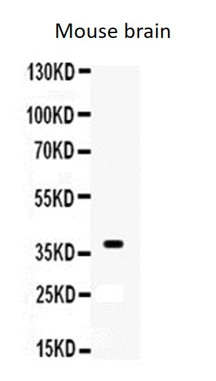 Anti-XRCC3