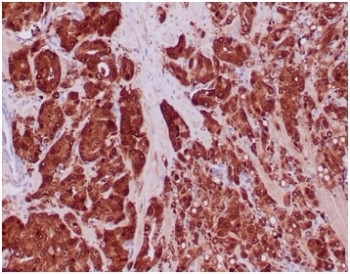 Anti-IDH1 / Isocitrate Dehydrogenase (R132H mutant), clone IDH1/6806R