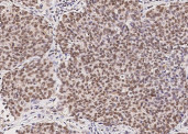 Anti-RPRD1B Monoclonal Antibody