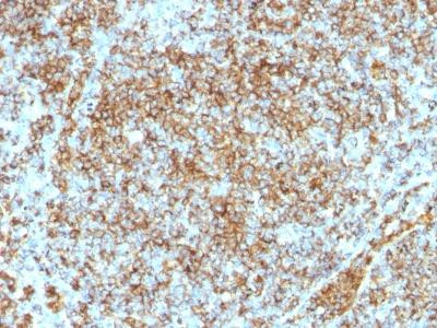 Anti-CD45RB (B-Cell Marker)(Clone: SPM569)