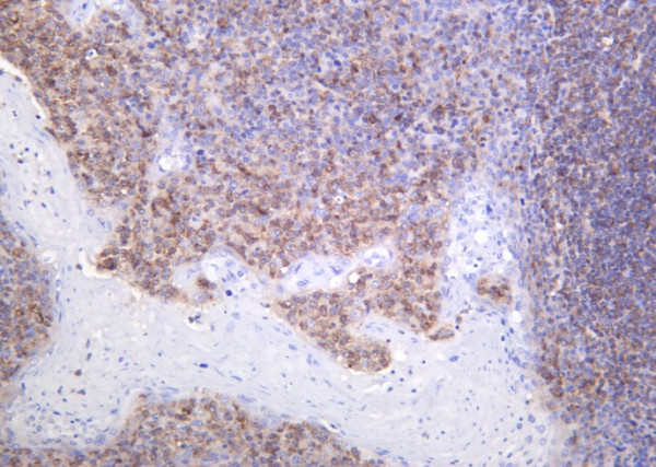 Anti-Recombinant AIM2, clone 8B9