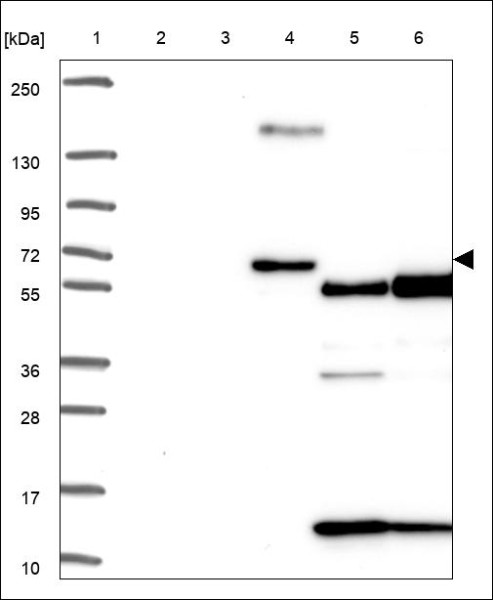 Anti-AMPD3