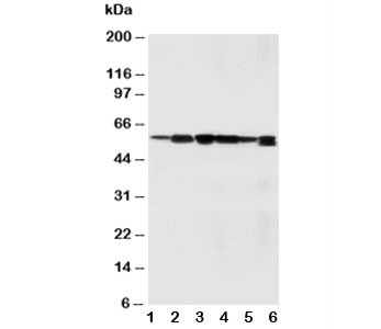 Anti-SSH3BP1