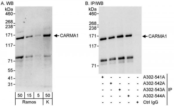 Anti-CARMA1