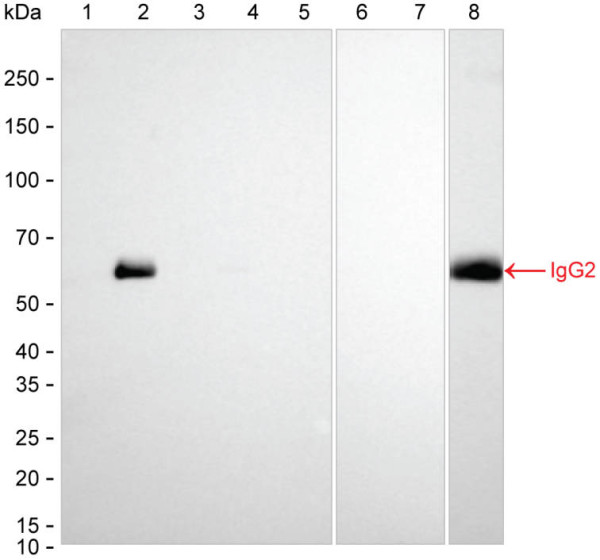 Anti-Human IgG2 Magnetic Beads