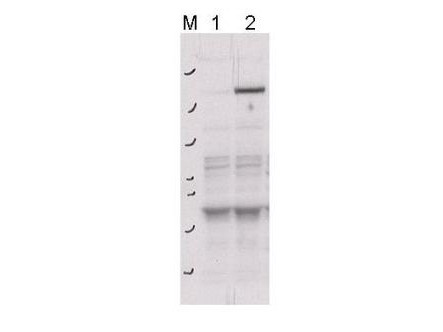 Anti-phospho-Rock-2 (Rho-associated Protein Kinase-2) (Tyr256)