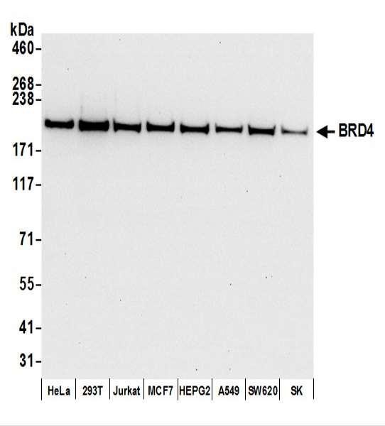 Anti-BRD4 Recombinant Monoclonal