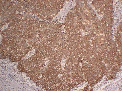 Anti-Cytokeratin 5