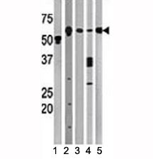 Anti-Beclin