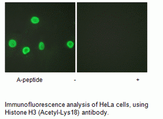 Anti-Histone H3 (Acetyl-Lys18)