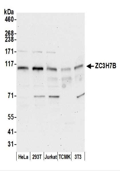 Anti-ZC3H7B