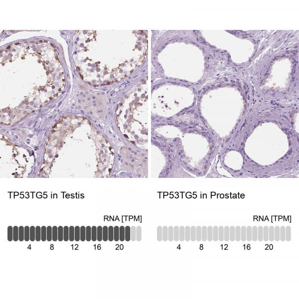 Anti-TP53TG5