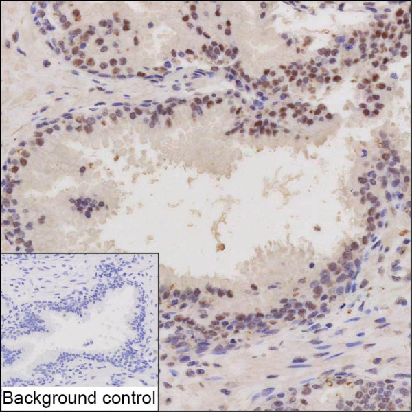 Anti-ANKRD36BP1