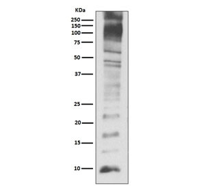 Anti-Ubiquitin, clone DIG-21