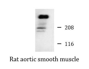 Anti-AKAP12 / Gravin