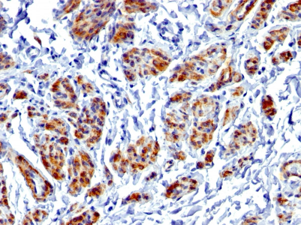 Anti-Caldesmon, HMW (h-Caldesmon) (Smooth Muscle Marker), recombinant antibody, clone CALD1/1424R