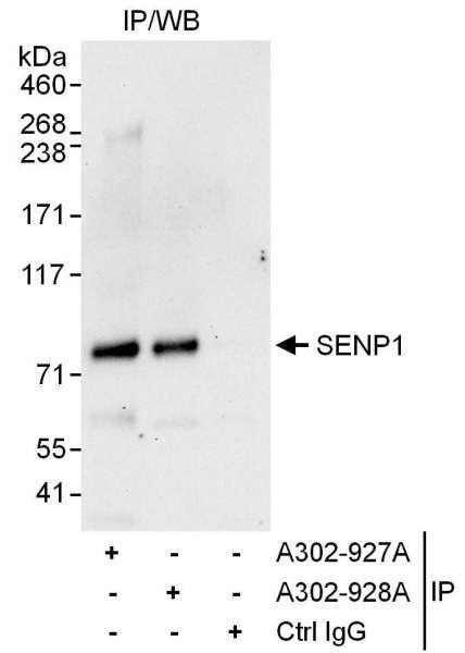 Anti-SENP1