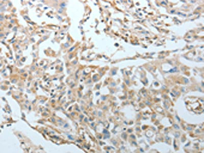 Anti-CRMP1