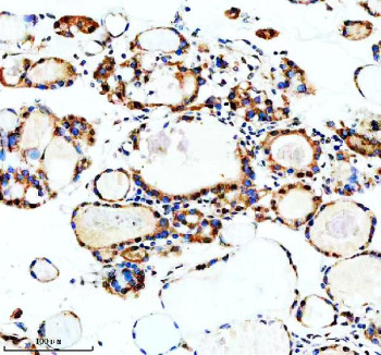 Anti-MSI2 / Musashi RNA-binding protein 2