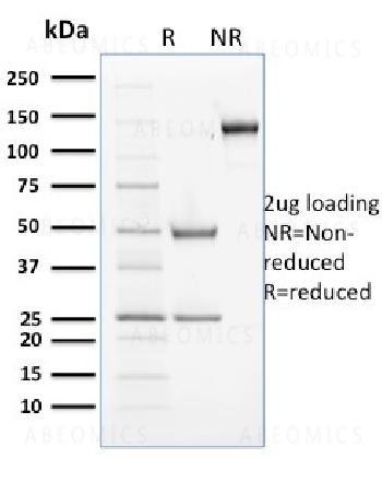 Anti-Cyclin B2 Monoclonal Antibody (Clone: X29.2)