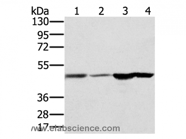Anti-RNH1