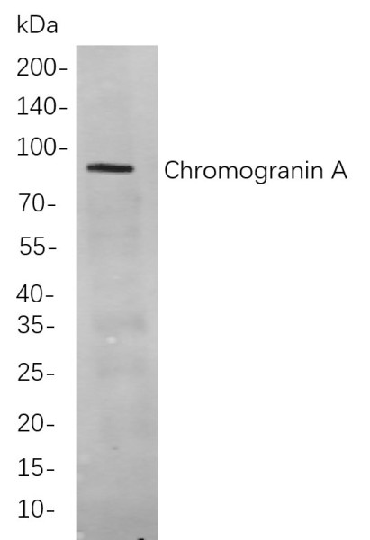 Anti-Recombinant Chromogranin A, clone 11B4