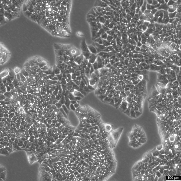 NCI-H1944 Cells