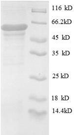 UDP-N-acetylglucosamine--peptide N-acetylglucosaminyltransferase 110KDA subunit (OGT), partial, huma