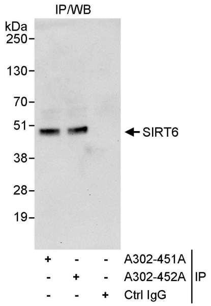 Anti-Sirt6