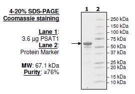 PSAT1, human recombinant protein, N-terminal His-tag
