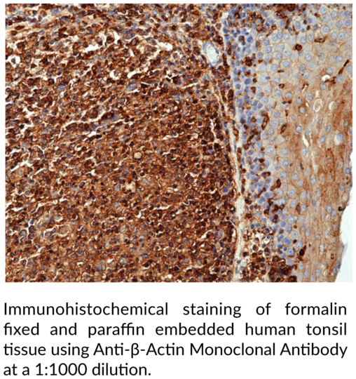 Anti-beta-Actin (N-Term) Rabbit