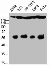 Anti-Cleaved-NOTCH4 (V1432)