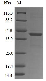 fMet-Leu-Phe receptor (FPR1), partial, human, recombinant